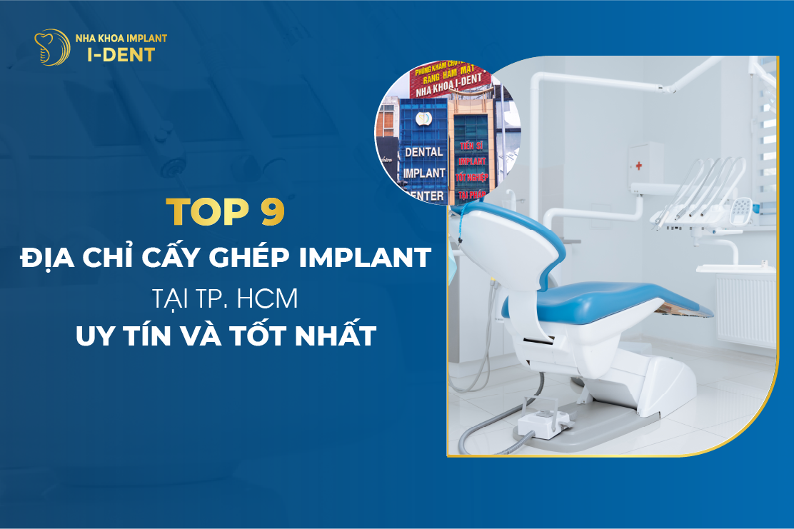 Top 9 Địa Chỉ Cấy Ghép Implant Tại TPHCM Uy Tín, Chất Lượng