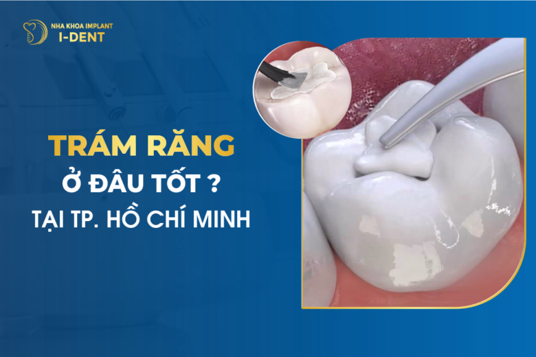 Trám Răng Ở Đâu Tốt Ở Tp.HCM