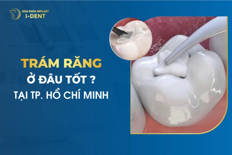 Trám Răng Ở Đâu Tốt Ở Tp.HCM