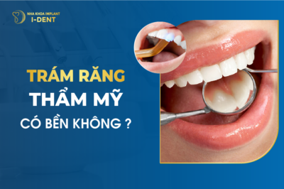 Trám Răng Thẩm Mỹ Có Bền Không