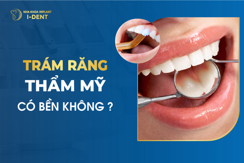 Trám Răng Thẩm Mỹ Có Bền Không