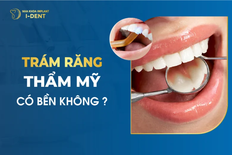 Trám Răng Thẩm Mỹ Có Bền Không