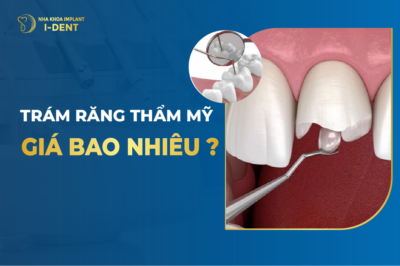 Trám Răng Giá Bao Nhiêu? Bảng Giá Trám Răng