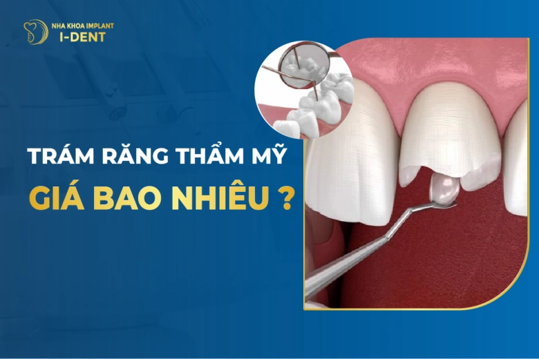 Trám Răng Giá Bao Nhiêu? Bảng Giá Trám Răng