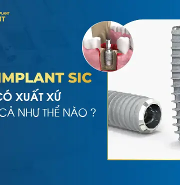 Implant SIC Có Xuất Xứ Và Giá Cả Như Thế Nào?
