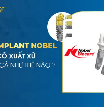 Trụ Implant Nobel Có Xuất Xứ Và Giá Cả Như Thế Nào?