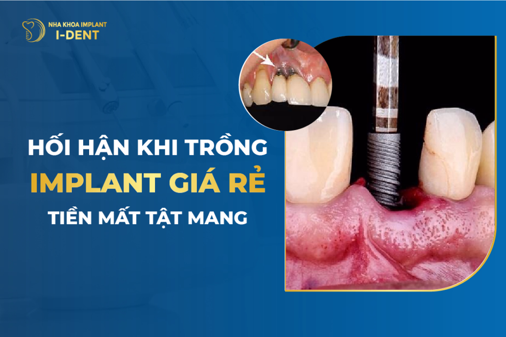 tác hại của việc trồng răng implant