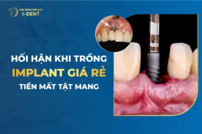 tác hại của việc trồng răng implant