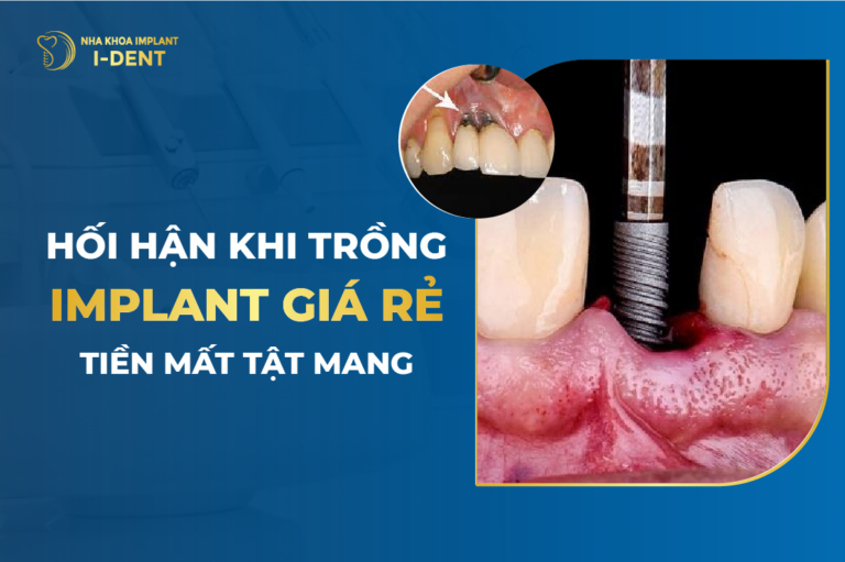 tác hại của việc trồng răng implant