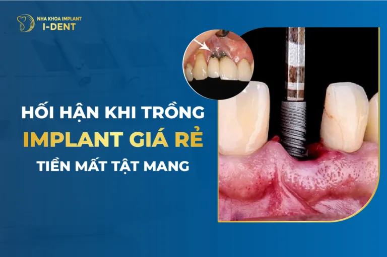 tác hại của việc trồng răng implant