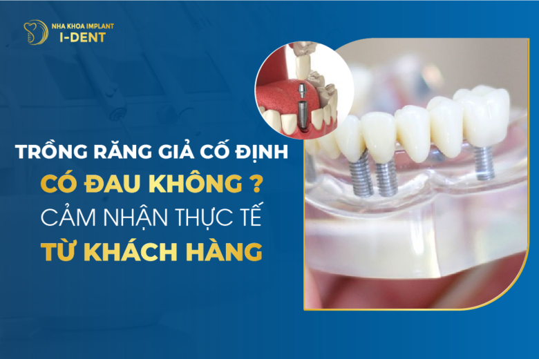 Trồng Răng Giả Cố Định Có Đau Không? Cảm Nhận Thực Tế Từ Khách Hàng