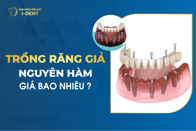 Trồng Răng Giả Nguyên Hàm Giá Bao Nhiêu?