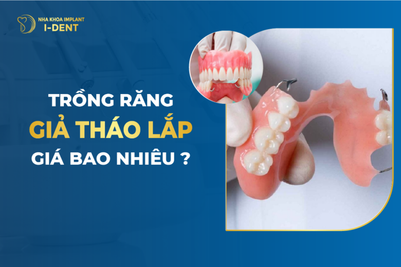 Trồng Răng Giả Tháo Lắp Giá Bao Nhiêu?