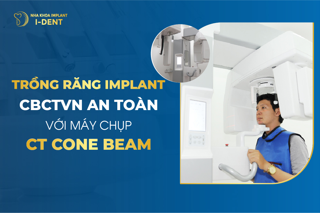 Trồng Răng Implant CBCTVN An Toàn Với Máy Chụp Ct Cone Beam