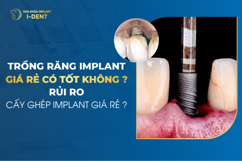 Trồng Răng Implant Giá Rẻ Có Tốt Không? Rủi Ro Cấy Ghép Implant Giá Rẻ