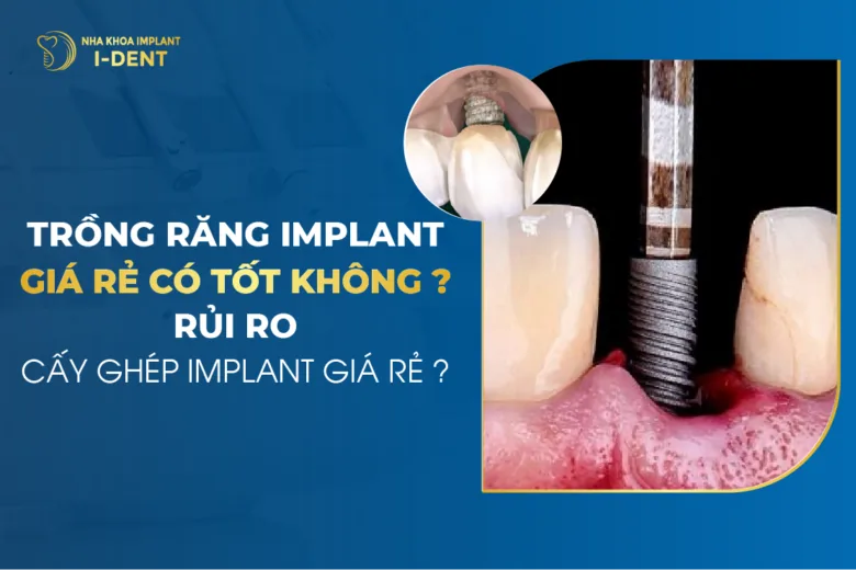Trồng Răng Implant Giá Rẻ Có Tốt Không? Rủi Ro Cấy Ghép Implant Giá Rẻ