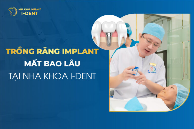 Trồng Răng Implant Mất Bao Lâu Tại Nha Khoa I-DENT