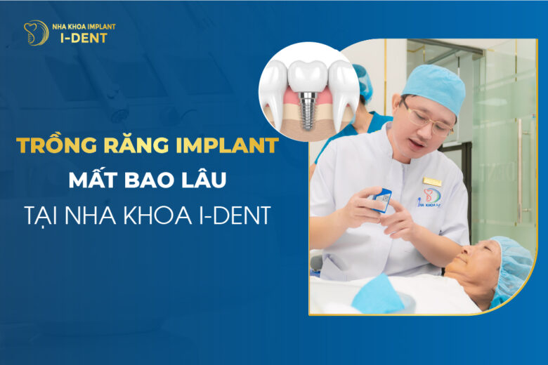 Trồng Răng Implant Mất Bao Lâu Tại Nha Khoa I-DENT