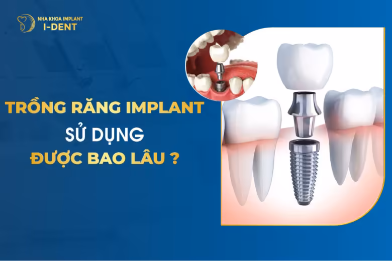 trồng răng implant được bao lâu