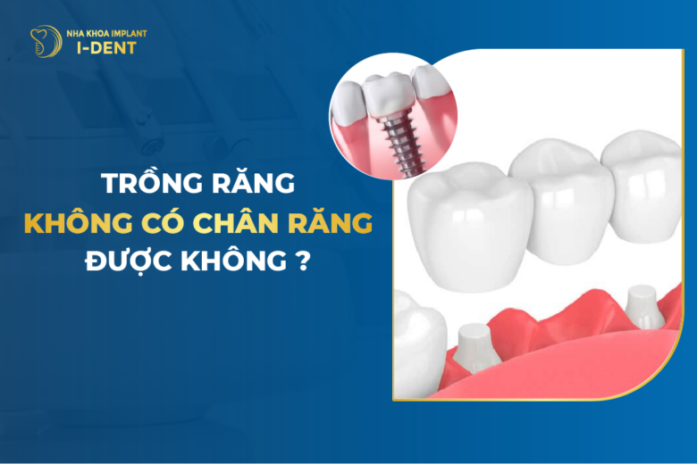 Trồng Răng Không Có Chân Răng Được Không?