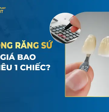 Trồng Răng Sứ Giá Bao Nhiêu 1 Chiếc