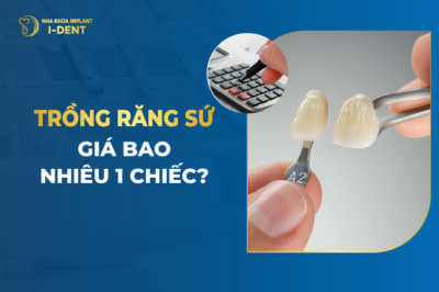 Trồng Răng Sứ Giá Bao Nhiêu 1 Chiếc