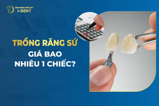 Trồng Răng Sứ Giá Bao Nhiêu 1 Chiếc