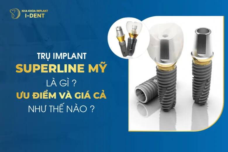 Trụ Implant Superline Mỹ Là Gì Ưu Điểm Và Giá Cả Như Thế Nào
