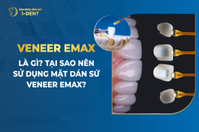 Veneer Emax Là Gì- Tại Sao Nên Sử Dụng Mặt Dán Sứ Veneer Emax-