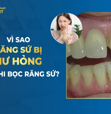Vì Sao Răng Sứ Bị Hư Hỏng Sau Khi Bọc Răng Sứ-