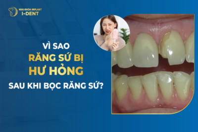 Vì Sao Răng Sứ Bị Hư Hỏng Sau Khi Bọc Răng Sứ-