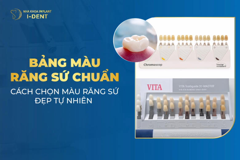 Bảng màu răng sứ chuẩn hiện nay và cách chọn màu răng sứ đẹp tự nhiên