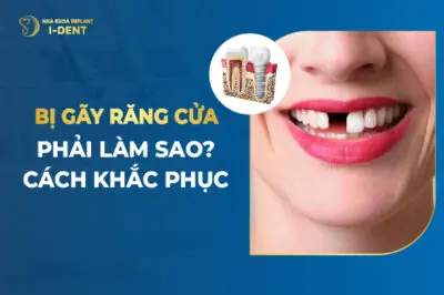 Bị Gãy Răng Cửa Phải Làm Sao? Cách Khắc Phục