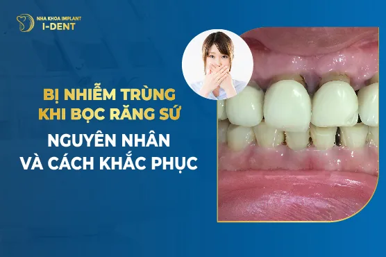 răng bọc sứ bị nhiễm trùng
