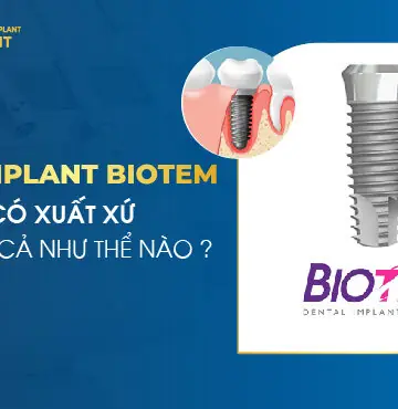 Trụ Implant Biotem Có Xuất Xứ Và Giá Cả Như Thế Nào?