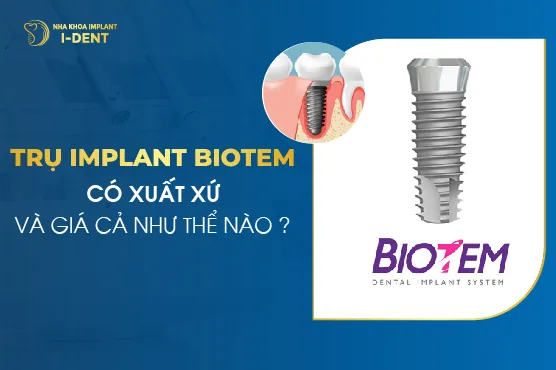 Trụ Implant Biotem Có Xuất Xứ Và Giá Cả Như Thế Nào?