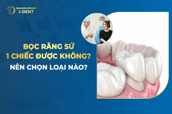 Bọc Răng Sứ 1 Chiếc Được Không? Nên Chọn Loại Nào?