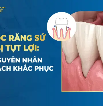 bọc răng sứ bị tụt lợi