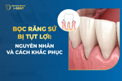 bọc răng sứ bị tụt lợi