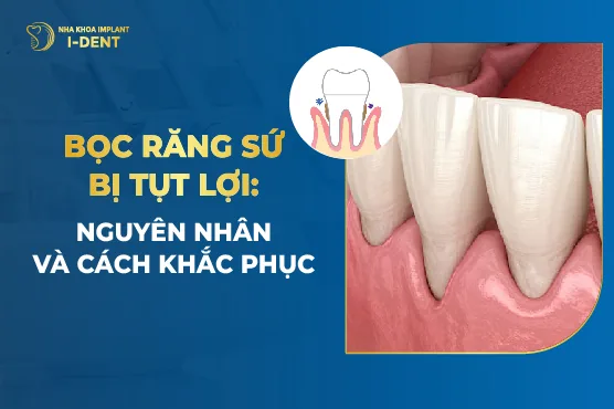 bọc răng sứ bị tụt lợi