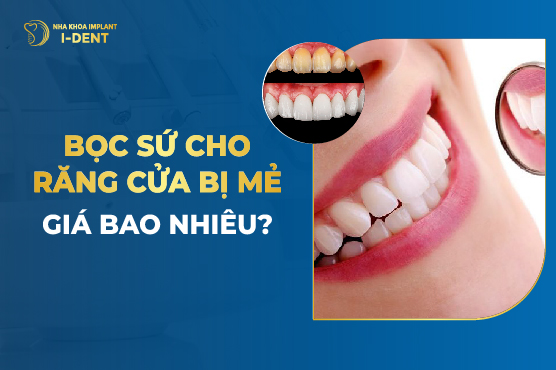Các biện pháp khắc phục răng cửa bị sâu một cách hiệu quả là gì?
