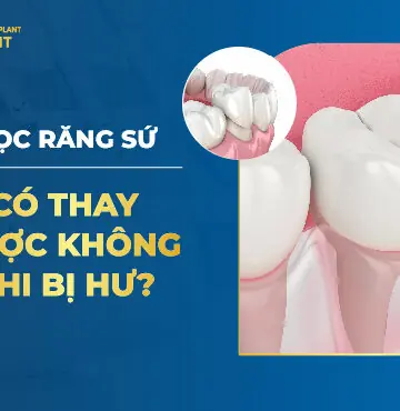 Bọc Răng Sứ Có Thay Được Không Khi Bị Hư?