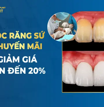 Bọc Răng Sứ Khuyến Mãi Giảm Giá Lên Đến 20%