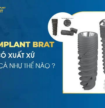 Trụ Implant Brat Có Xuất Xứ Và Giá Cả Như thế Nào?