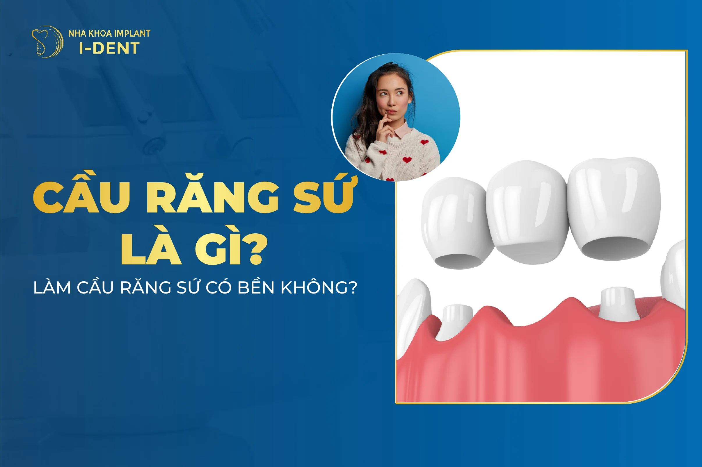 Cầu răng sứ là gì? Làm cầu răng sứ có bền không?