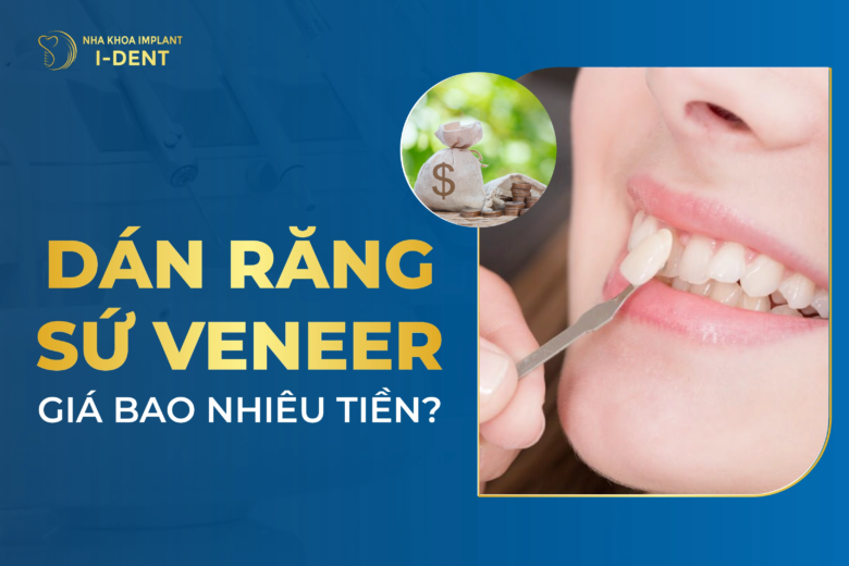 Dán Răng Sứ Veneer Giá Bao Nhiêu Tiền? Bảng Giá 2024