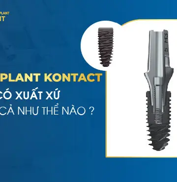 Trụ Implant Kontact Có Xuất Xứ Và Giá Cả Như Thế Nào?