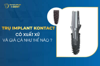 Trụ Implant Kontact Có Xuất Xứ Và Giá Cả Như Thế Nào?
