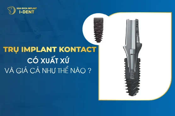 Trụ Implant Kontact Có Xuất Xứ Và Giá Cả Như Thế Nào?