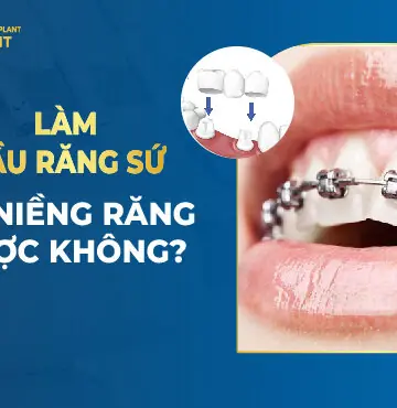 Làm cầu răng sứ có niềng răng được không?